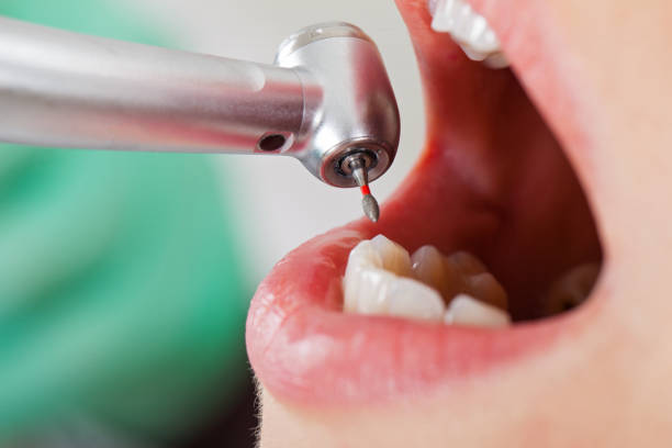 Best Emergency Dentist for Special Needs Patients in Mineola, TX